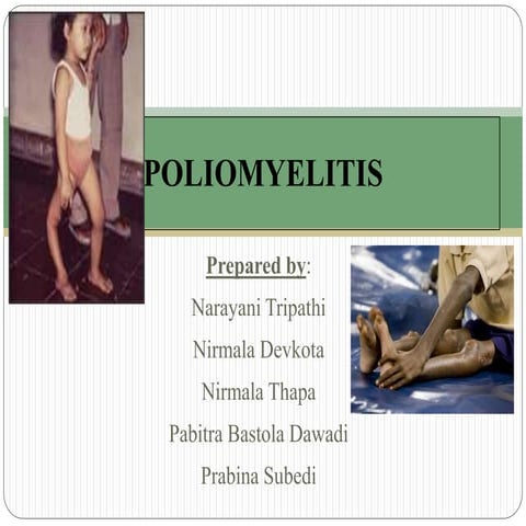 Poliomyelitis uploaded by Samrat Gurung