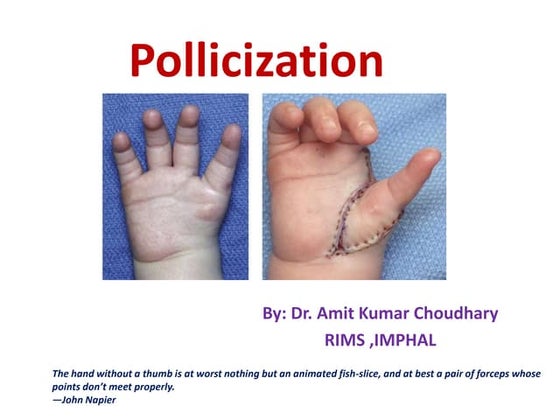 Kleinert and Duran Protocols.pptx