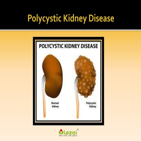 Polycystic kidney disease