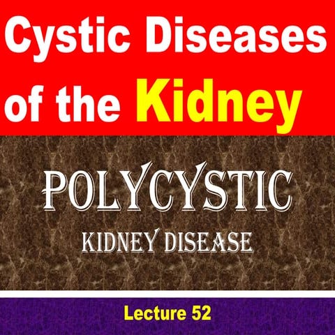 Polycystic kidney disease for students