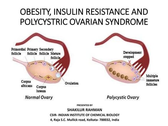 More Insulin - When There is Insulin Resistance | PPTX