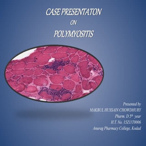 CASE PRESENTATON on POLYMYOSITIS | PPTX