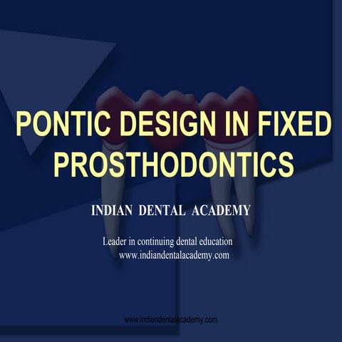 Pontics Design in fixed prosthodontics
