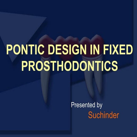 Pontic and pontic designs | PPTX
