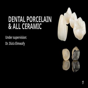 Dental Ceramics and Porcelain fused to metal | PPTX