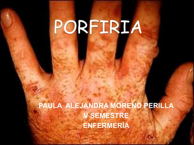 Porfiria