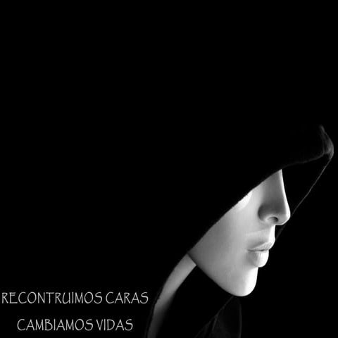 Portafolio ioir cirugia craneomaxilofacial (adultos y niños)