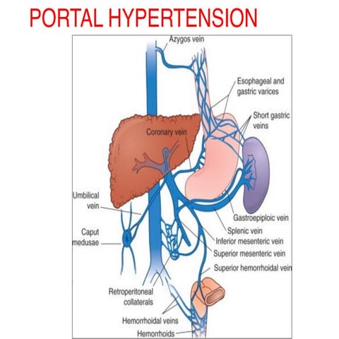 Portal hypertension