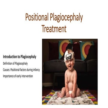 Effective Treatment Solutions for Positional Plagiocephaly | PPTX