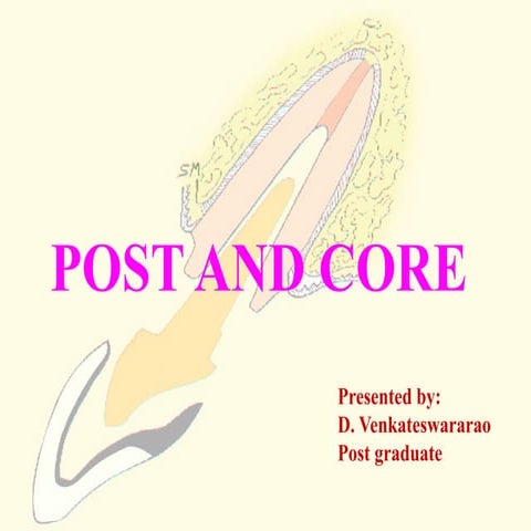 Prosthetic restoration of endodontically treated tooth | PPTX