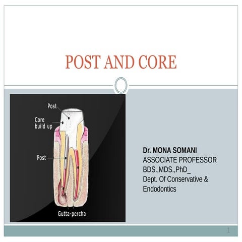Post and core buildup | PPTX