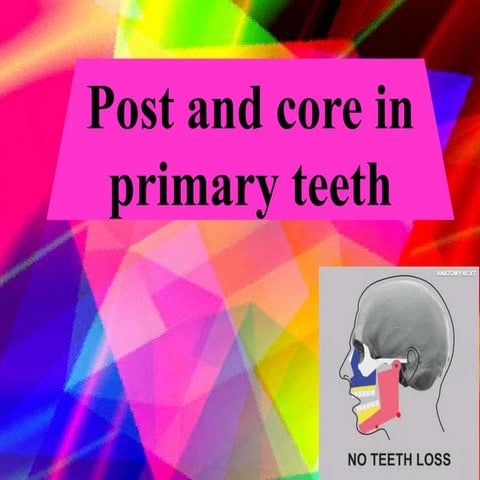 Post and core in primary teeth final to present