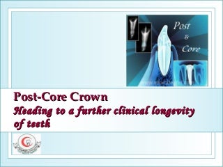 Post core crown