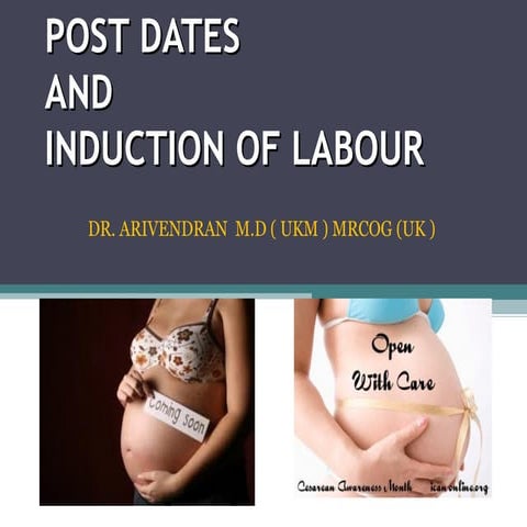Post dates and induction