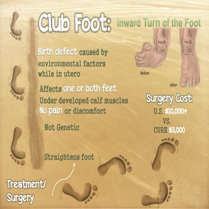 CURE (2012): Cleft Palate Infographic | PDF