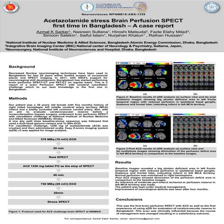 Acetazolamide stress brain perfusion SPECT