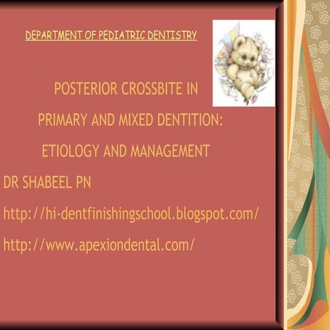 Posterior crossbite in_primary_and_mixed_dentition_-_etiology_and_management_...