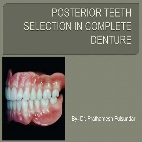 Posterior Teeth Selection in Complete Denture