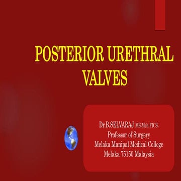 Posterior urethral valves- Pediatric Surgery