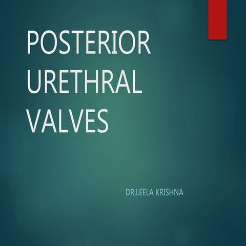 POSTERIOR URETERAL VALVES (PUV )