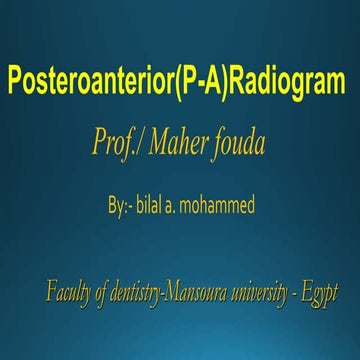 Posteroanterior  radiogram
