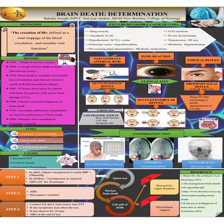 How much of the brain must be dead2012.pptx