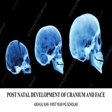 POST NATAL DEVELOPMENT OF CRANIUM AND FACE.pptx
