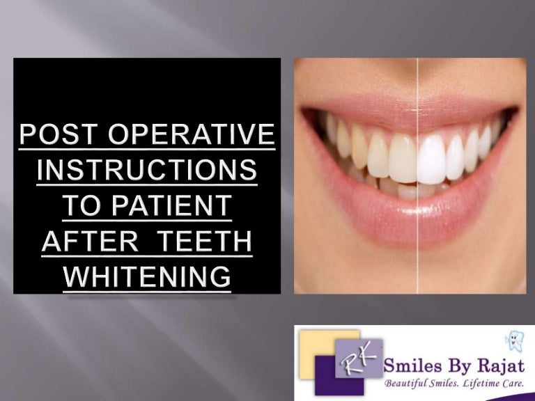 Post Operative Instructions Teeth whitening Ashok Vihar Delhi