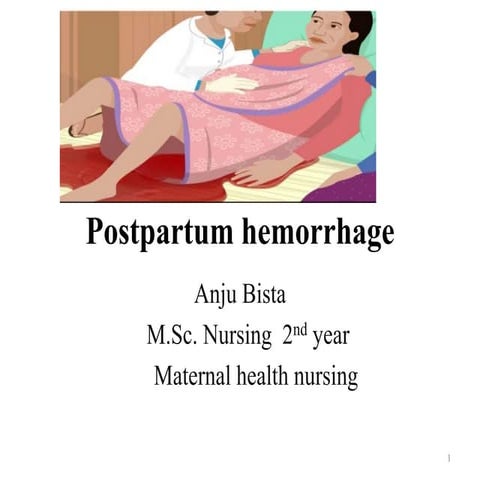 Postpartum hemorrhage - with pictures.pptx