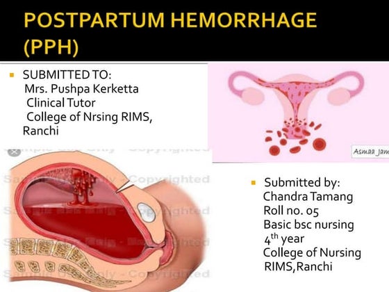Pph | PPTX