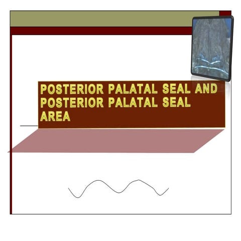 POST R PALATAL SEAL  by Dr Sana khan …….