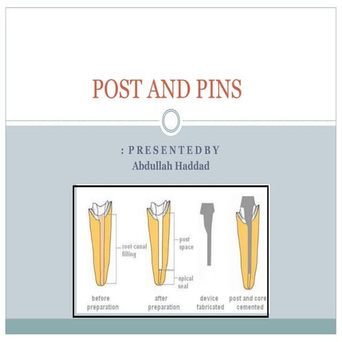 Comprehensive Guide to Post and Pins in Endodontic Restorations | PDF