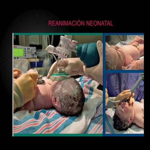 Power_Point_Reanimacion_neonatal_Rodrigiuez_A_Suarez_L_Tropea_N.pptx