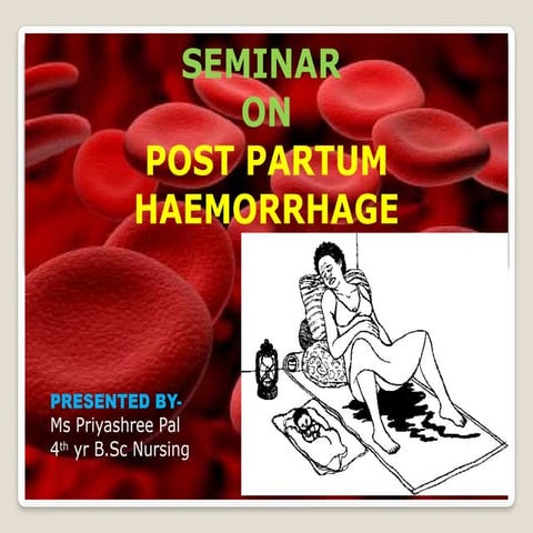 “ Management of postpartum haemorrhage ”