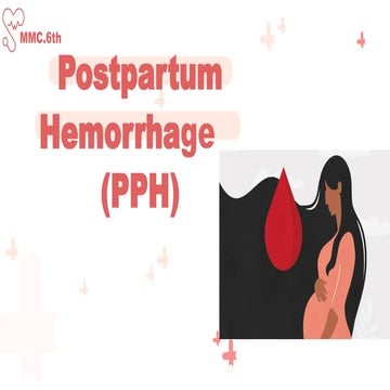 Post partum haemorrhage in obestric emergencies | PPTX