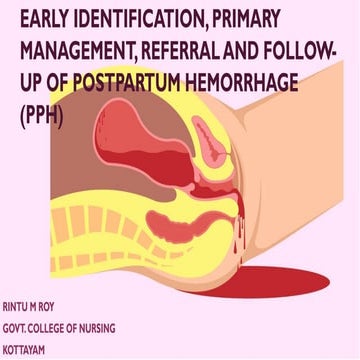 Post pattum hemarrage management in community health nursing | PPTX