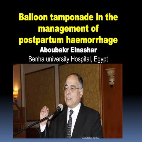 Baloon tamponade in management of postpartum haemorrhage