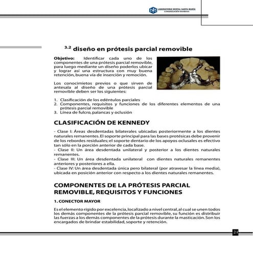 Diseños de Prótesis Parcial Removible - Clase I, II, II y IV | PDF
