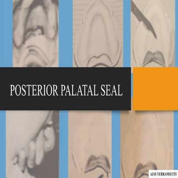 Posterior palatal seal