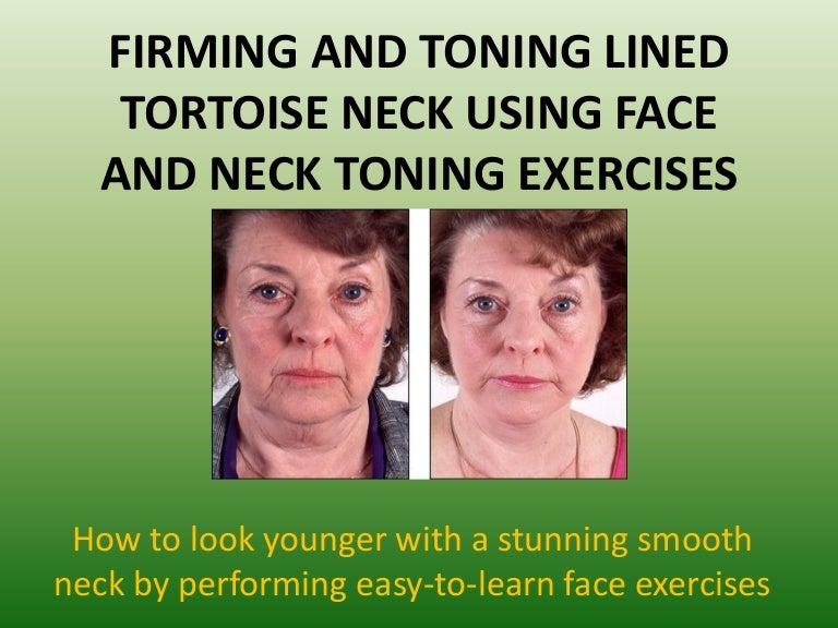 The Termination Of Turkey Neck Execute Your Own Natural Neck Lift Ut