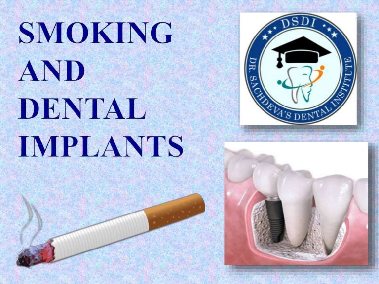 Smoking affecting implants Dental Implants and Tobacco