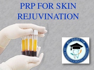 Prp Skin Rejuvenation - Platelet Rich Plasma - PRP and Vampire Facial -