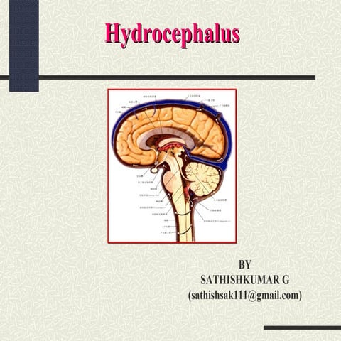 Hydrocephalus