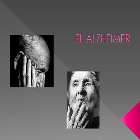 Ppt Alzheimer Pptx
