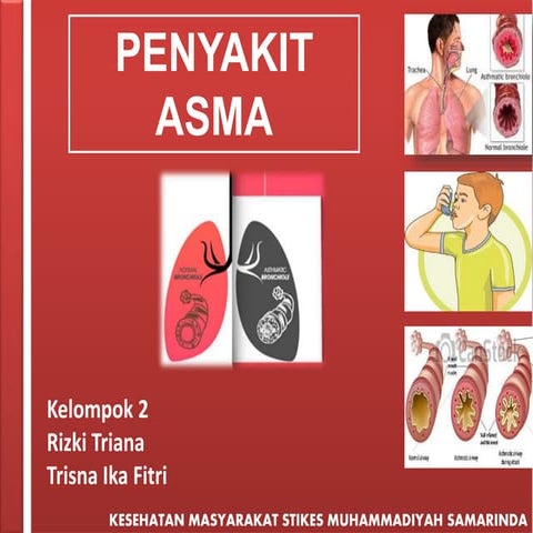 Ppt Penyakit Asma