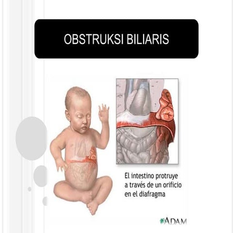 OBSTRUKSI BILIARIS