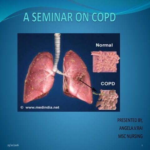Ppt copd | PPTX
