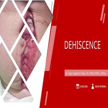 Comprehensive Understanding and Management of Surgical Wound Dehiscence ...