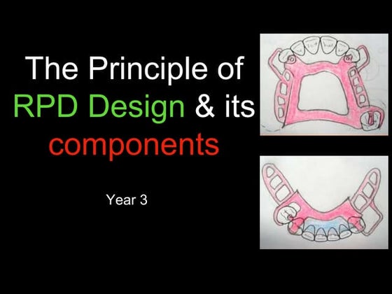 RPD Major Connectors | PPSX | Dental Health | Diseases and Conditions