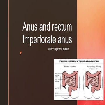 PPT Imperforated Anus.pptx